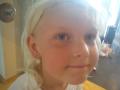 Ruth med nye �redobber. Det synes ikke s� godt p� bildet, men de er formet som bl� blomster